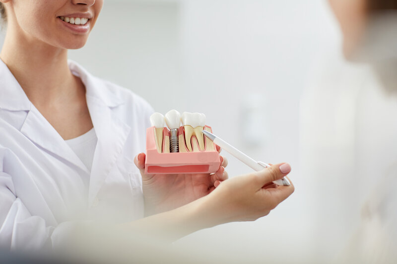 Dental Implants - Are They Suitable For Me?